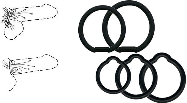 Constriction or Cock Rings