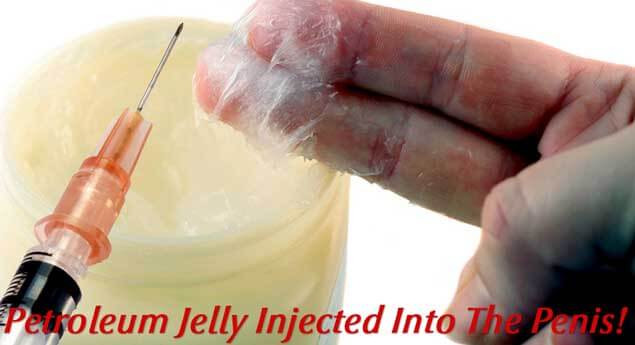 Petroleum Jelly Penis Injection